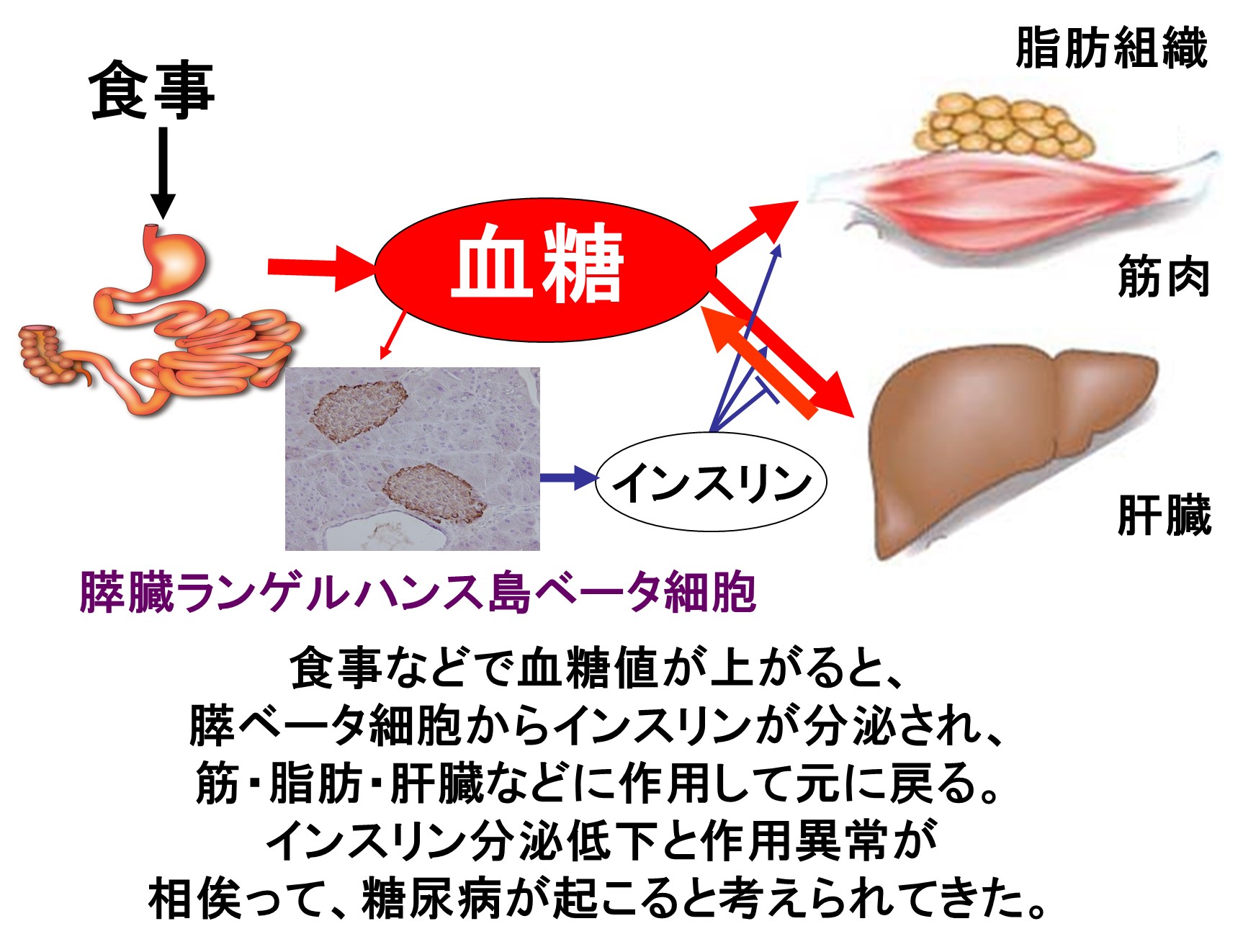 自身のメカニズムで糖尿病を根治できる日」はきっと来る